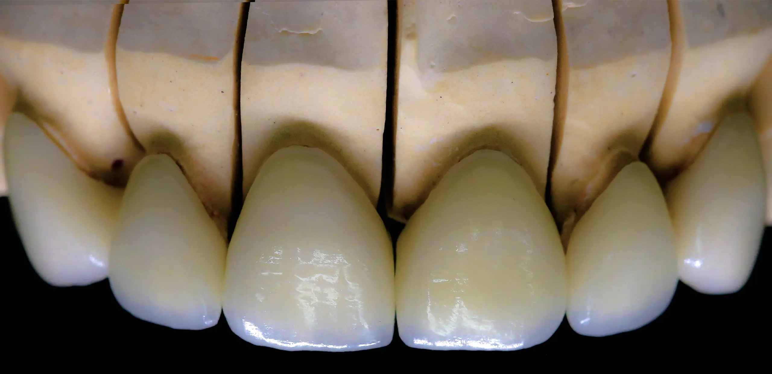 Reabilitação Oral e Estética